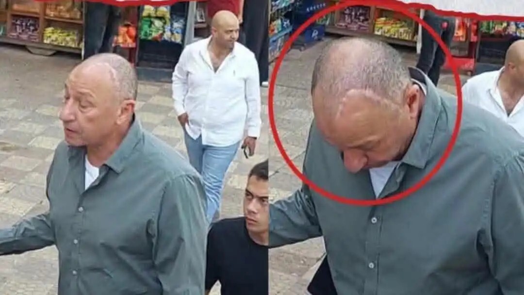 “جرح كبير في الرأس”.. محمود الخطيب يثير الجدل بصورة مفاجئة