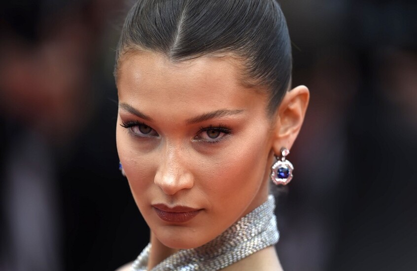 طريقة مشي عارضة أزياء فيكتوريا سيكريت تثير قلق المعجبين