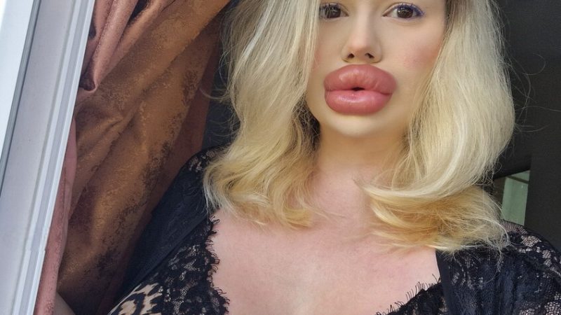 رسالة من صاحبة “أكبر شفاه في العالم”