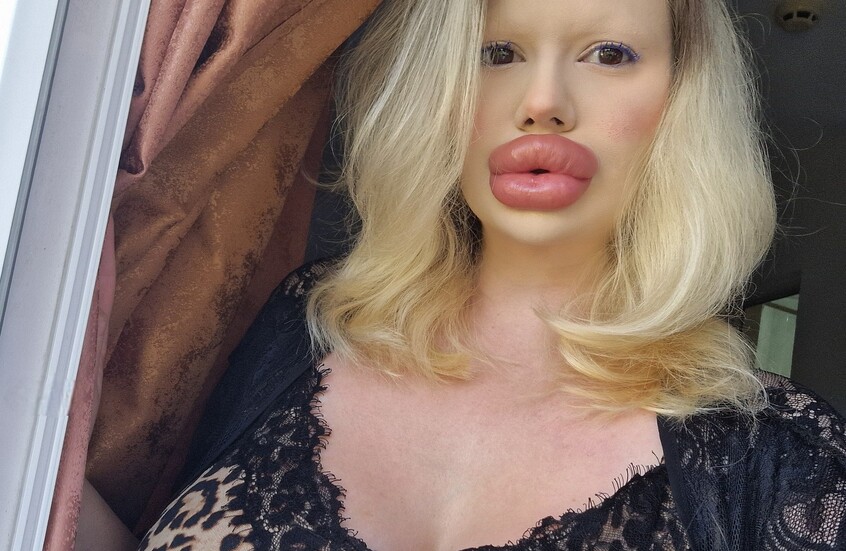 رسالة من صاحبة “أكبر شفاه في العالم”