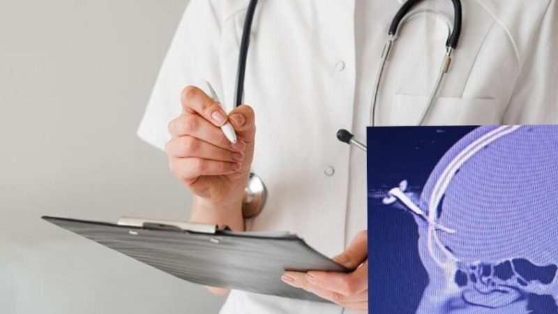 “مفتاح سيارة يستقر في جبينه”.. لاعب سابق يتعرض لإصابة غريبة