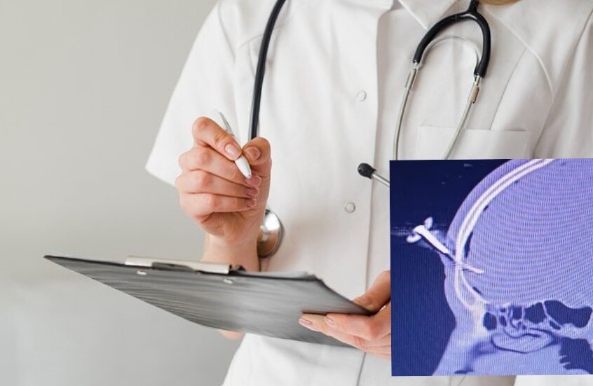 “مفتاح سيارة يستقر في جبينه”.. لاعب سابق يتعرض لإصابة غريبة