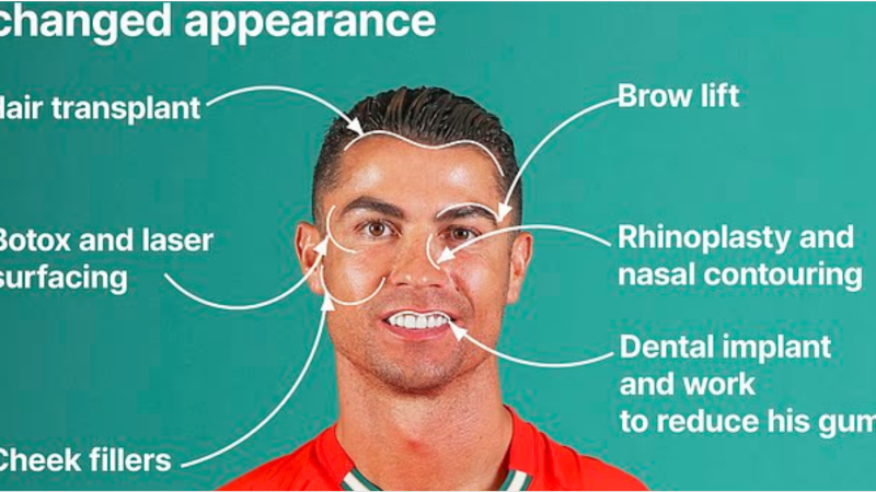 بوتوكس ليزر رفع الحاجبين.. جراح تجميل يكشف أسرار تغير ملامح كريستيانو رونالدو خلال 20 عاما