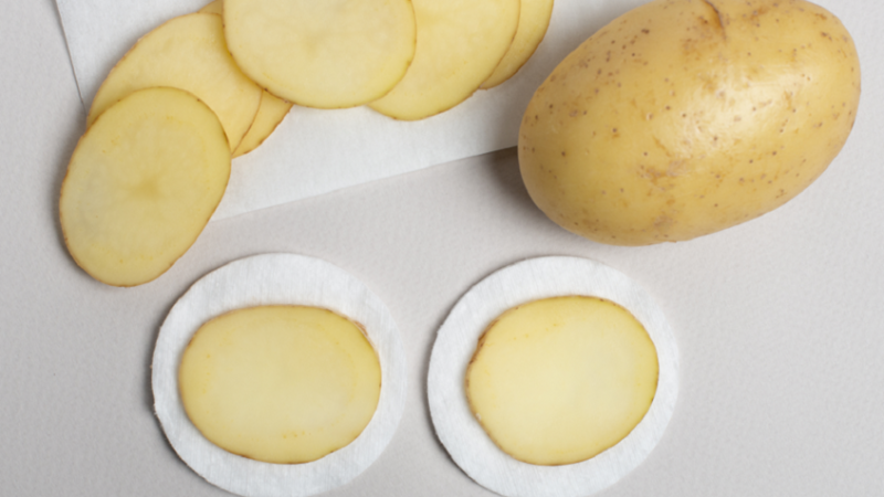 البطاطا.. “كنز حقيقي” للعناية بالبشرة