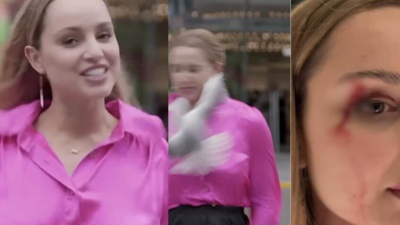 طائر يصطدم بوجه مراسلة نيوزيلاندية على المباشر ويصيبها بجروح (فيديو)