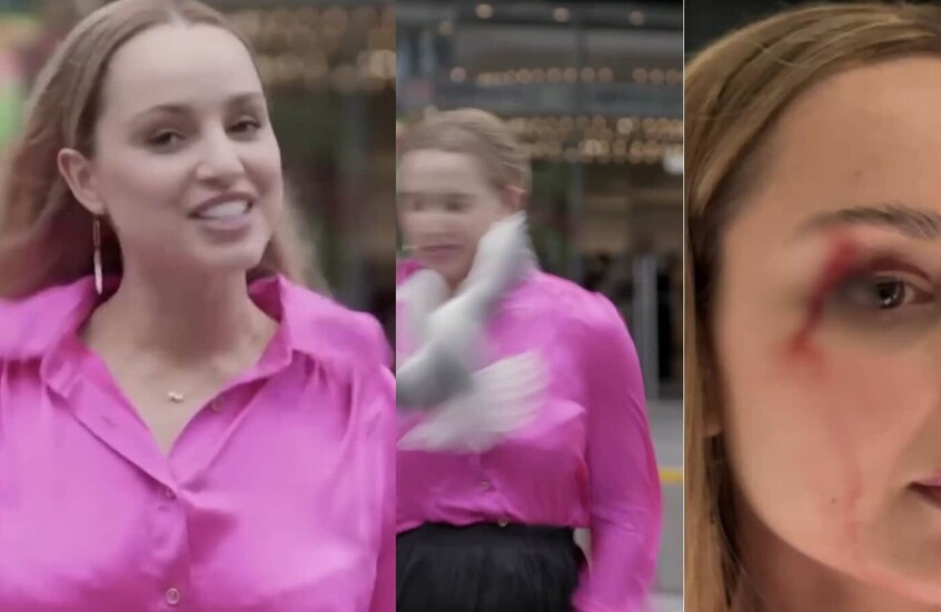 طائر يصطدم بوجه مراسلة نيوزيلاندية على المباشر ويصيبها بجروح (فيديو)