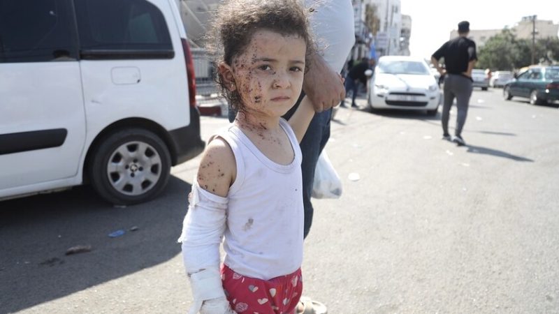 الأمم المتحدة: حوالي 95 ألف طفل في غزة يعانون من سوء التغذية الحاد