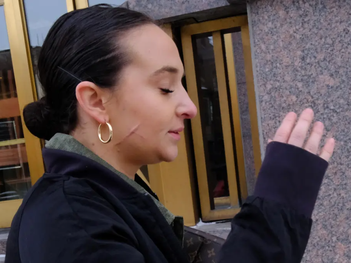 ندوب مروعة وعبارة “عاهرة ترامب” على جسدها.. صورة تظهر آثار هجوم مفبرك على مساعدة جمهورية سابقة (صور)