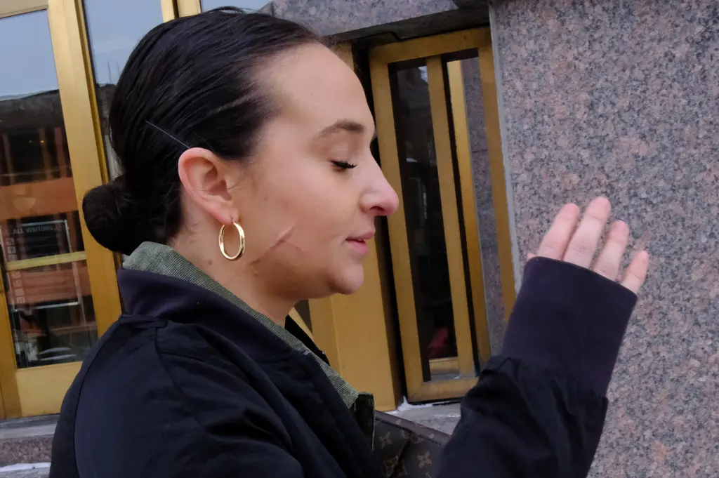 ندوب مروعة وعبارة “عاهرة ترامب” على جسدها.. صورة تظهر آثار هجوم مفبرك على مساعدة جمهورية سابقة (صور)