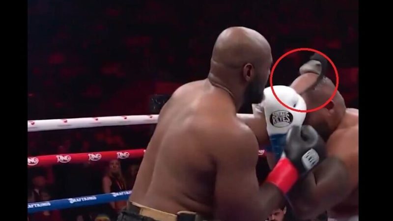 “نزع شعره المستعار”.. لحظة محرجة و”طريفة” لملاكم على الحلبة (فيديو)