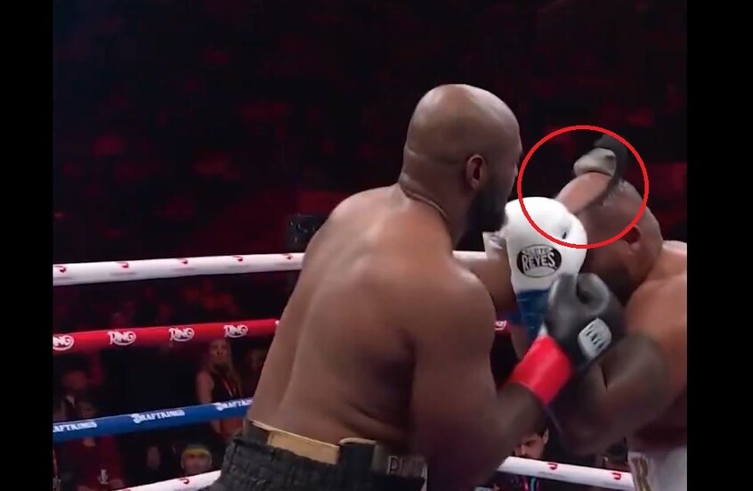 “نزع شعره المستعار”.. لحظة محرجة و”طريفة” لملاكم على الحلبة (فيديو)